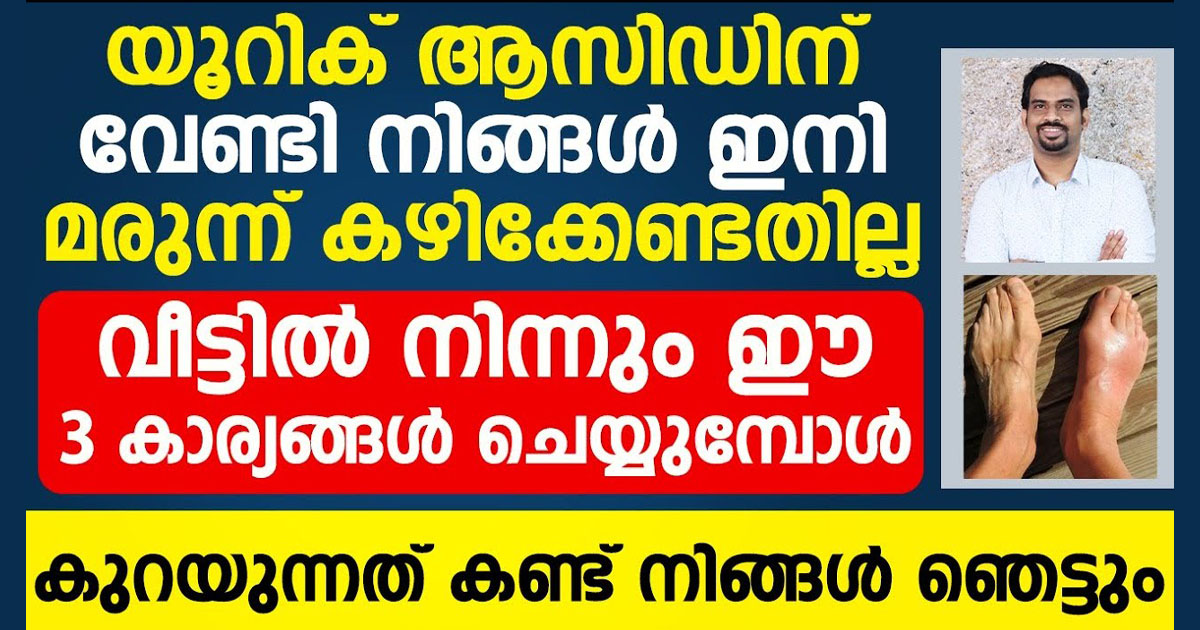 യൂറിക്കാസിടിന് മരുന്നു കഴിക്കുന്നവരാണോ..!! ഇനി വീട്ടിൽ ഈ മൂന്ന് കാര്യങ്ങൾ ചെയ്താൽ മതി… ഇത് അറിയേണ്ടേത് തന്നെ..