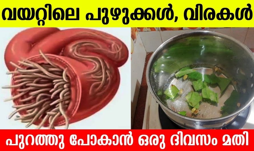 വിട്ടുമാറാത്ത വിരശല്യം നിങ്ങളുടെ കുട്ടികളിൽ കാണാറുണ്ടോ ? പ്രതിവിധി ദാ ഇവിടെയുണ്ട് കണ്ടു നോക്കൂ…| To Get Rid Of Intestinal Worms