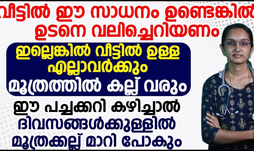 കിഡ്നി സ്റ്റോണിനെ മാറി കടക്കാൻ ഇത്തരം കാര്യങ്ങൾ ഭക്ഷണത്തിൽ ഉൾപ്പെടുത്തൂ. ഇത് നിസ്സാരമായി കരുതരുതേ…| Kidney stone treatment