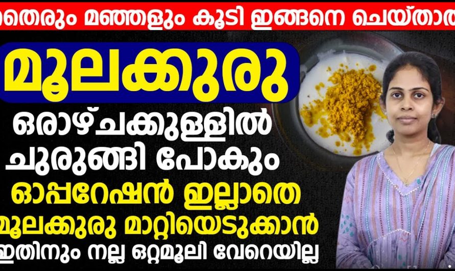 മൂലക്കുരു ഫിഷർ എന്നീ രോഗാവസ്ഥകളെ ജീവിതത്തിലെ നീക്കം ചെയ്യാൻ ഇത്തരം കാര്യങ്ങൾ ശ്രദ്ധിച്ചാൽ മതി. കണ്ടു നോക്കൂ.