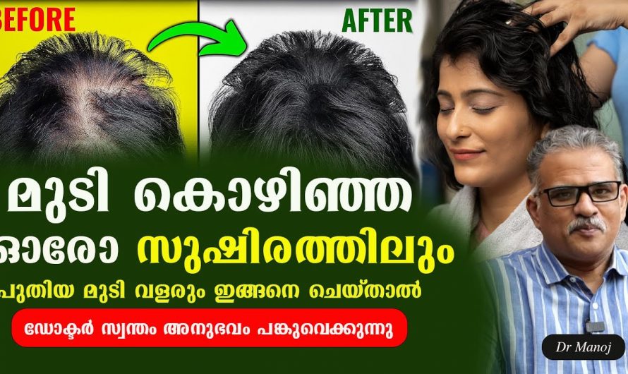 മുടികൊഴിച്ചിൽ നിങ്ങളുടെ മാനസിക സമ്മർദ്ദം വർധിപ്പിക്കുന്നുണ്ടോ? ഇതാ ഇതിനൊരു പുത്തൻ വഴി. കണ്ടു നോക്കൂ