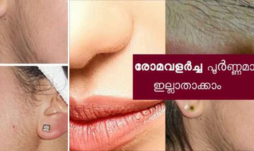 അധികരാമ വളർച്ച നിങ്ങളിൽ കാണാറുണ്ടോ?  ഉണ്ടെങ്കിൽ ഇത് തീർച്ചയായും കാണുക.