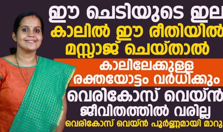 കാലുകളിലെ തടിച്ചു വീർത്ത ഞെരമ്പുകൾ നിങ്ങളിൽ അസ്വസ്ഥത സൃഷ്ടിക്കുന്നുണ്ടോ? കണ്ടു നോക്കൂ…| To prevent varicose veins