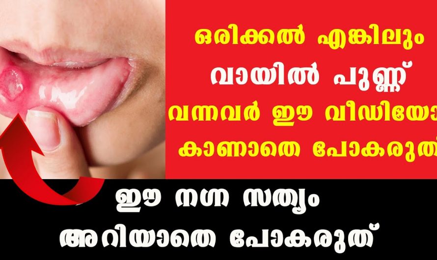 ദൈനംദിന ജീവിതത്തിൽ കടന്നുവരുന്ന ഇത്തരം പ്രശ്നങ്ങളുടെ കാരണങ്ങളെ ആരും തിരിച്ചറിയാതിരിക്കരുതേ .