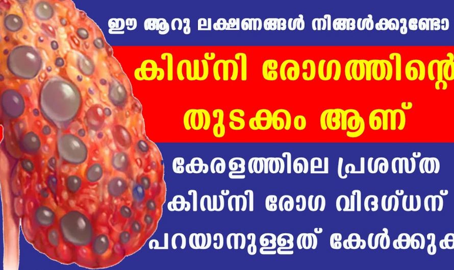 കിഡ്നി സംബന്ധമായ രോഗങ്ങളെ ഇത്തരം ലക്ഷണങ്ങളുടെ തിരിച്ചറിയാം.  കണ്ടു നോക്കൂ.