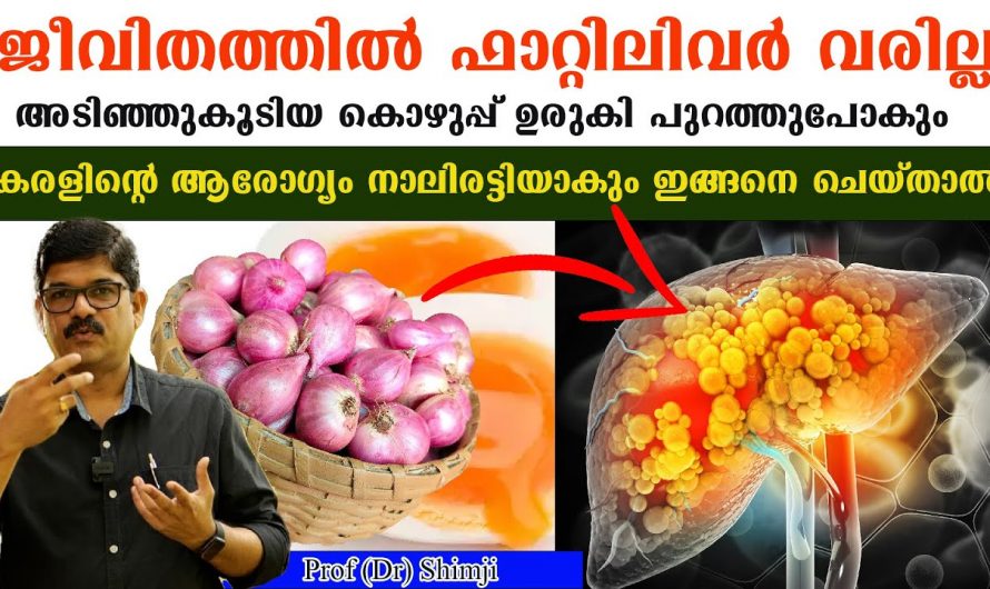 ഇതിന്റെ അളവ് കുറച്ചാൽ ശരീരത്തിലെ കൊഴുപ്പ് മുഴുവനായി പോകും ഇത്തരം കാര്യങ്ങൾ ആരും അറിയാതെ പോകരുതേ…| Fatty liver disease