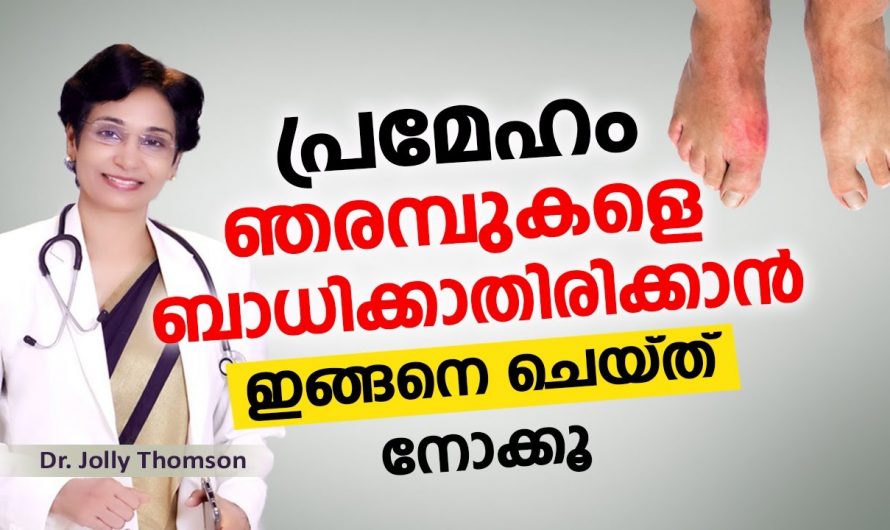 ഇത്രയും കാലവും ഇതിനെക്കുറിച്ച് നാം അറിയാതെ പോയല്ലോ. കണ്ടു നോക്കൂ…| Diabetes Avoid Neuropathy