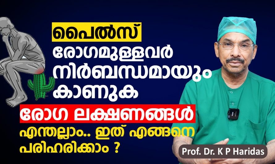 പൈൽസിന് മറികടക്കാൻ ഇത്രമാത്രം ചെയ്താൽ മതി. ഇവ കണ്ടില്ല എന്ന് നടിക്കരുത്…| Piles Treatment Malayalam