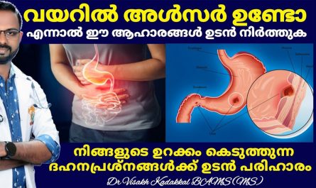 Stomach ulcer important 3 symptoms male