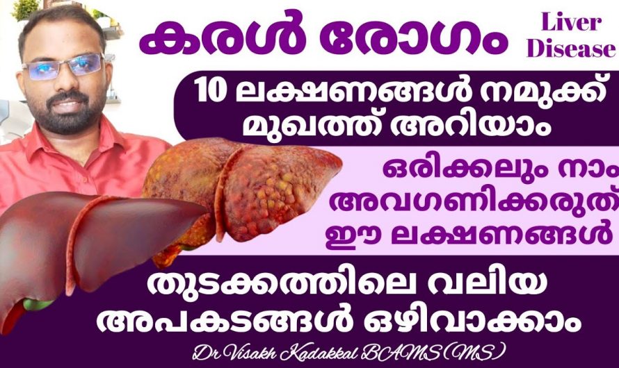 കരൾ രോഗങ്ങൾക്ക് നമ്മുടെ മുഖം കാണിച്ചുതരുന്ന ഇത്തരം ലക്ഷണങ്ങളെ ആരും അറിയാതെ പോകരുതേ.