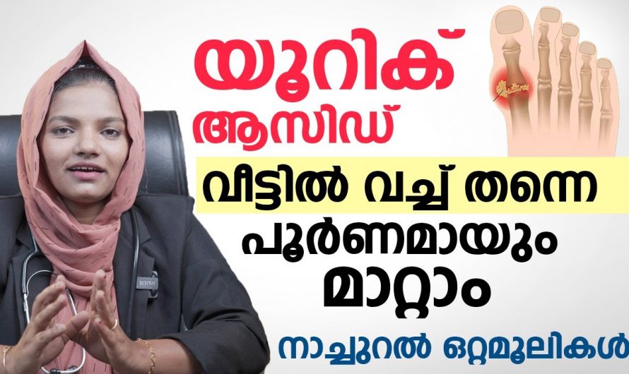 യൂറിക്കാസിഡ് ഒരു തരി പോലും അവശേഷിക്കാതെ പൂർണമായി തന്നെ അലിയിക്കാം.കണ്ടു നോക്കൂ.