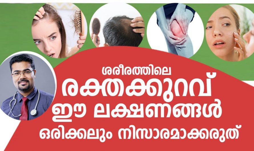 അമിതമായ ക്ഷീണം നിങ്ങളുടെ ജീവിതത്തിന്റെ താളം തെറ്റിക്കുന്നുണ്ടോ? ഇതിന്റെ ശരിയായ കാരണം ആരും അറിയാതെ പോകരുതേ…| 5 weird signs of iron deficiency