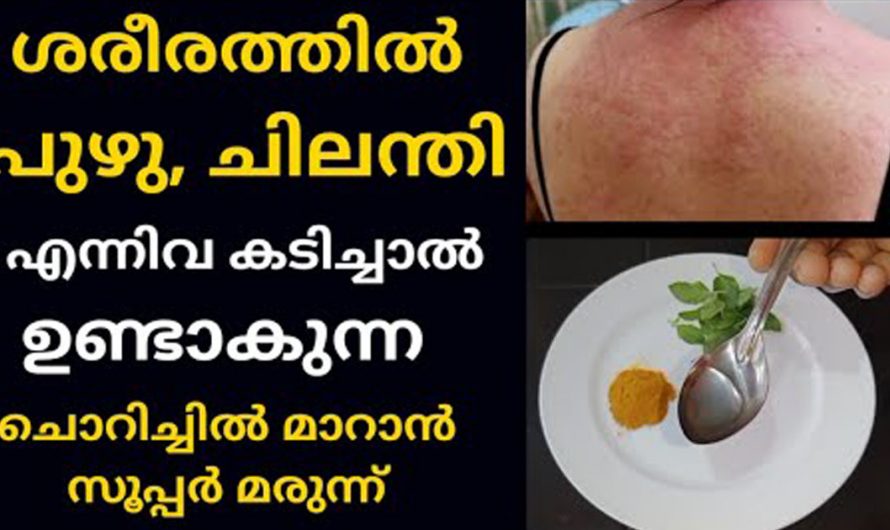 പഴുതാര പുഴു എന്നിവ അരിക്കുന്നത് മൂലം ഉണ്ടാകുന്ന ചൊറിച്ചിലകൾക്ക്  ഇതാ ഒരു പരിഹാരമാർഗ്ഗം. ഇതാരും കാണാതെ പോകരുതേ.