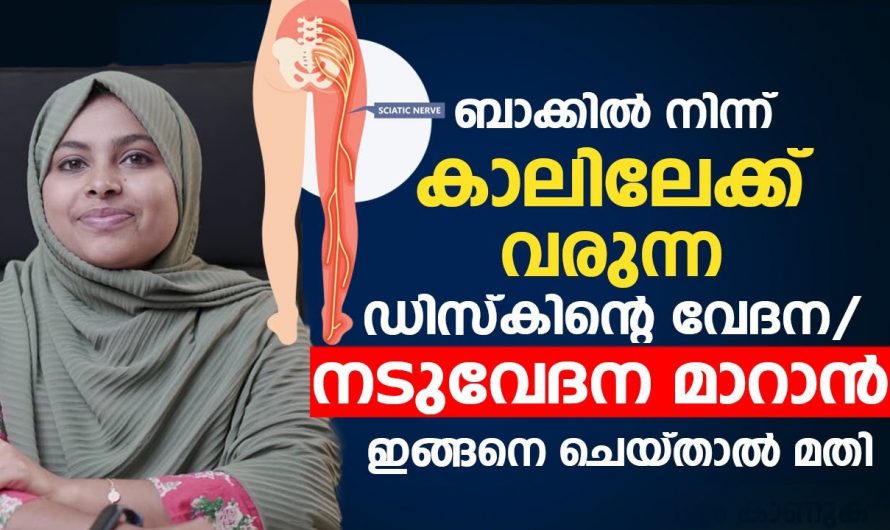 ഇത്തരം കാര്യങ്ങൾ ചെയ്യുക നടുവേദന ജീവിതത്തിൽ ഒരിക്കലും വരില്ല.  ഇതിനെ ആരും നിസ്സാരമായി കാണരുതേ.