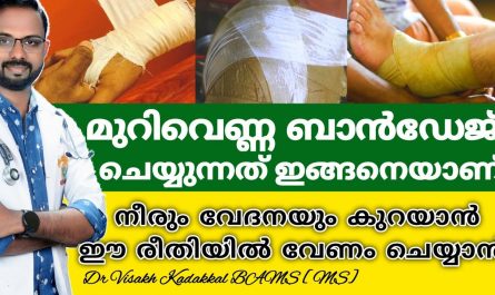 Murivenna Bandage For Joint Pain