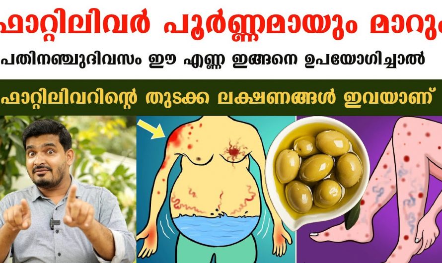 കരളിൽ അടിഞ്ഞുകൂടിയിട്ടുള്ള കൊഴുപ്പിനെ പൂർണമായിത്തന്നെ ഇല്ലാതാക്കാം. കണ്ടു നോക്കൂ…| Fatty liver symptoms