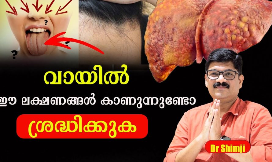 സ്ഥിരമായി ആന്റിബയോട്ടിക് എടുക്കുന്നവർ ആണോ നിങ്ങൾ? കണ്ട് നോക്കൂ.