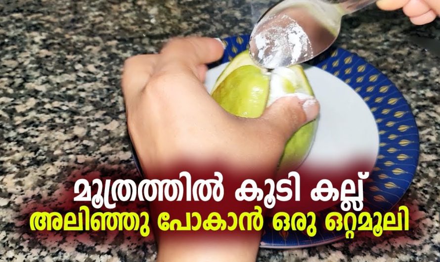 എത്ര വലിയ മൂത്രത്തിലെ കല്ലും നമുക്ക് അലിയിച്ചു കളയാo. ഇതാരും അറിയാതെ പോകരുതേ…| Kidney stone home remedy