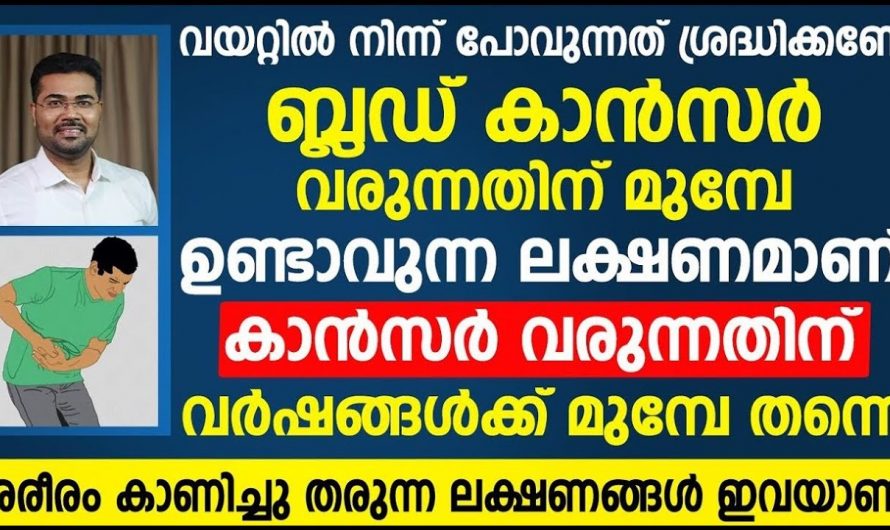 ഇത്തരം ലക്ഷണങ്ങൾ നിങ്ങളിൽ കാണുന്നുണ്ടോ ? എങ്കിൽ അത് ക്യാൻസറുകൾ അല്ല എന്ന് ഉറപ്പു വരുത്തേണ്ടതാണ്. കണ്ടു നോക്കൂ…| Blood cancer symptoms on skin