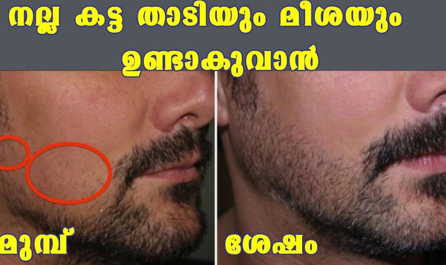 കട്ട താടിയും മീശയും നിങ്ങളിലെ ഒരു സ്വപ്നമാണോ? ഇത് ഉപയോഗിക്കൂ മാറ്റങ്ങൾ നിങ്ങൾക്ക് നേരിട്ട് അറിയാം. കണ്ടു നോക്കൂ.