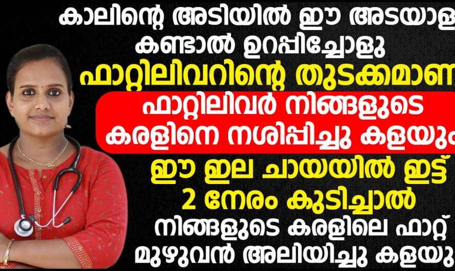 അമിതമായി ആഹാരം കഴിക്കുന്നവരാണോ നിങ്ങൾ? എങ്കിൽ ഫാറ്റി ലിവറിന്റെ സാധ്യത ഏറെയാണ് കണ്ടു നോക്കൂ…| Fatty liver symptoms on foot