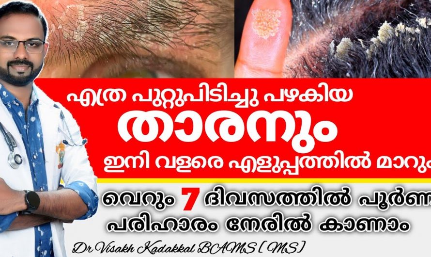 താരനെ മറികടക്കാൻ ഇത്രയ്ക്ക് എളുപ്പമായിരുന്നോ? ഇതാരും അറിയാതെ പോകരുതേ.