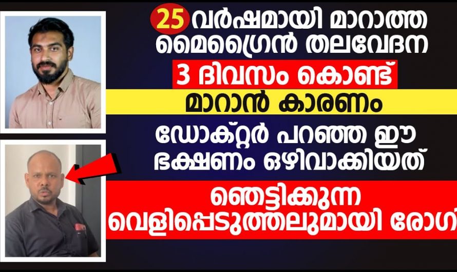 വർഷങ്ങൾ പഴക്കമുള്ള മൈഗ്രേൻ വേദനയെ ദിവസങ്ങൾ കൊണ്ട് നീക്കാം. ഇത്തരം കാര്യങ്ങൾ ആരും കാണാതെ പോകരുതേ.