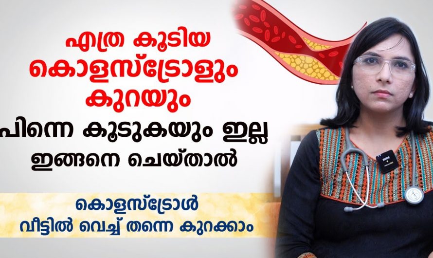 എത്ര കൂടിയ കൊളസ്ട്രോളിനെ കുറയ്ക്കാൻ ഇത്തരം കാര്യങ്ങൾ പിന്തുടരൂ. ഇത് ആരും നിസ്സാരമായി കാണരുതേ…| Cholesterol reducing food