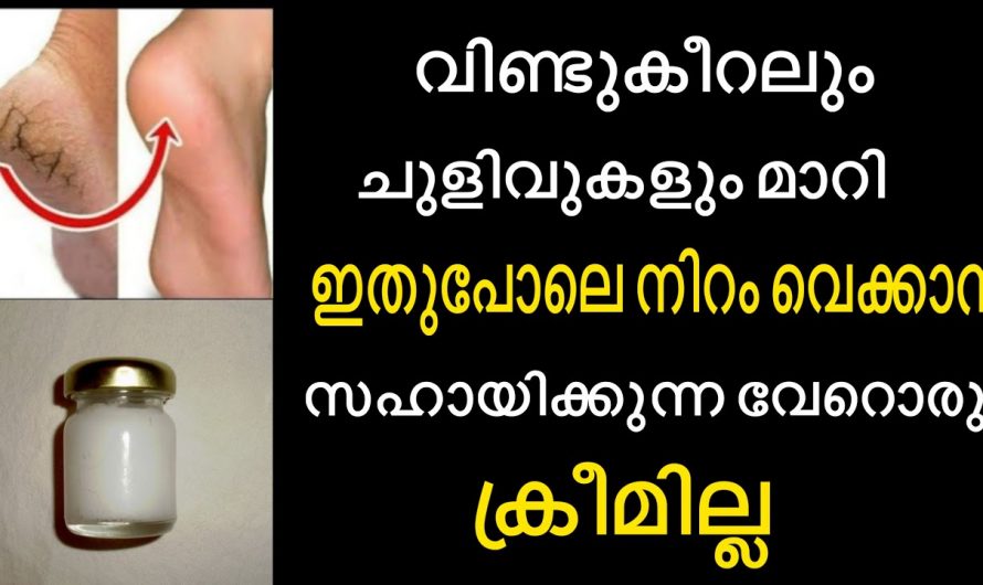 മോയ്സ്ചറൈസർ വാങ്ങി ഇനി പണം കളയണ്ട. വരൾച്ച മാറാനും നിറം വയ്ക്കാനും  ഇനി ഇതു മതി കണ്ടു നോക്കൂ…|  Cracked heels treatment