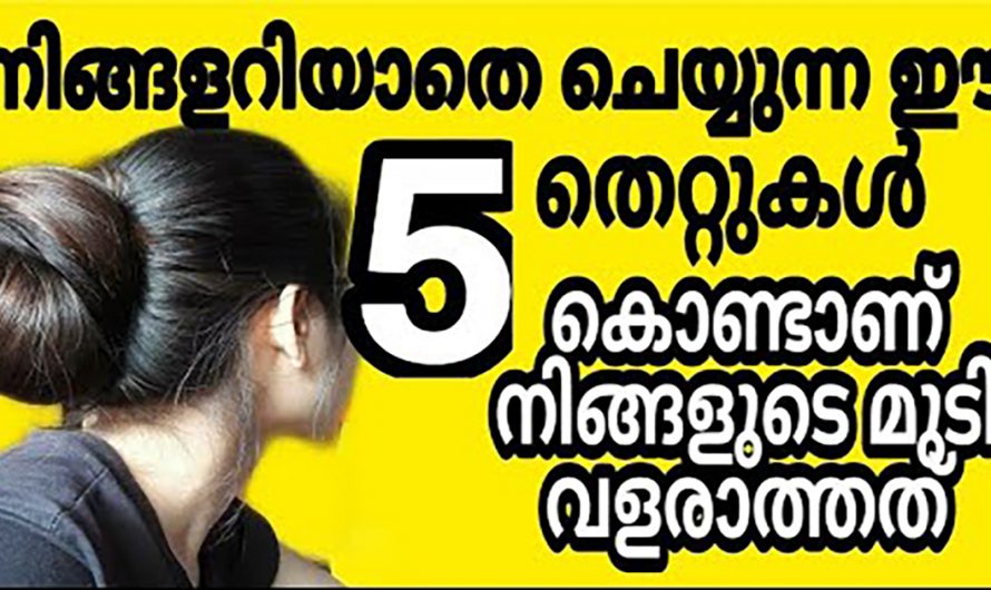 മുടിയിഴകൾ തഴച്ചു വളരാത്തതിന്റെ യഥാർത്ഥ കാരണങ്ങളെ ആരും തിരിച്ചറിയാതെ പോകരുതേ.