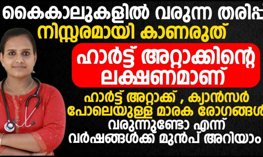 അനിയന്ത്രിതമായിട്ടുള്ള ഷുഗർ നിങ്ങളിൽ കാണുന്നുണ്ടോ ? ഇത് നിങ്ങളെ ന്യൂറോപതിയിലേക്ക് നയിക്കുന്നു. കണ്ടു നോക്കൂ.