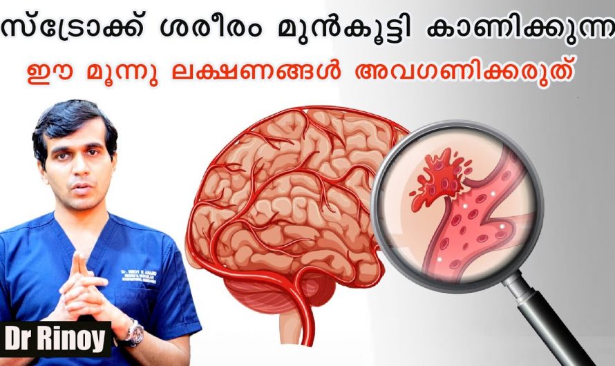 ശരീരത്തിന്റെ ബാലൻസ് ഇല്ലാതായി ചുണ്ട് ഒരു സൈഡിലേക്ക് കോടുന്നതുപോലെ നിങ്ങളിൽ കാണാറുണ്ടോ? എങ്കിൽ ഇതാരും അറിയാതെ പോകല്ലേ.