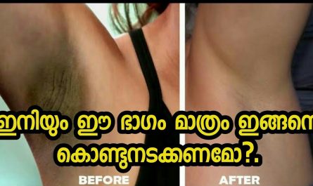 Underarm whitening home remedy fast