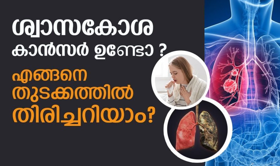 ശ്വാസകോശ ക്യാൻസറുകൾക്ക് ശരീരം കാണിക്കുന്ന ലക്ഷണങ്ങളെ ആരും തിരിച്ചറിയാതെ പോകരുതേ…| Lung cancer symptoms and prevention