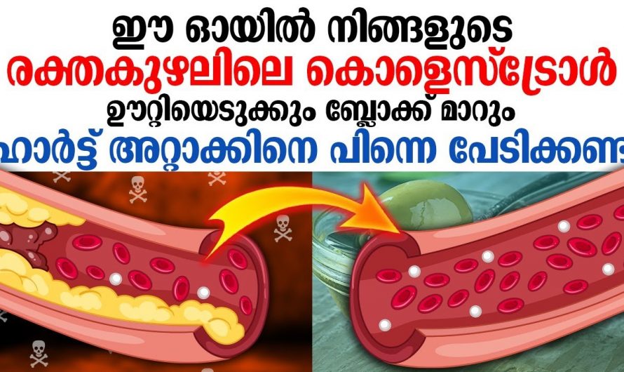 കൊളസ്ട്രോൾ മൂലം ബുദ്ധിമുട്ടുന്നവരാണോ നിങ്ങൾ ? എങ്കിൽ ഈയൊരു എണ്ണ ഉപയോഗിക്കു മാറ്റം സ്വയം തിരിച്ചറിയൂ.