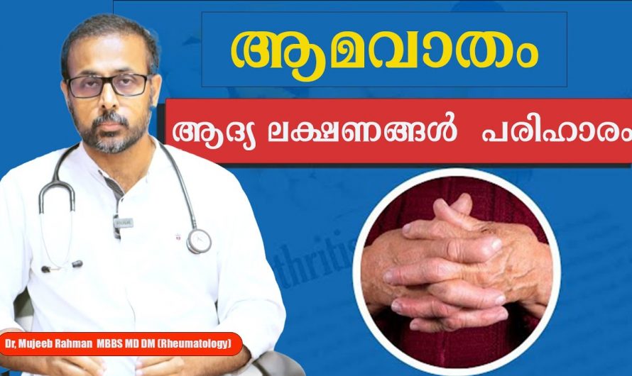 ആമവാതത്തിന് ശരീരം പ്രകടമാക്കുന്ന ഇത്തരം ലക്ഷണങ്ങളെ ഇതുവരെയും തിരിച്ചറിയാതെ പോയല്ലോ. കണ്ടു നോക്കൂ…| Rheumatoid arthritis symptoms