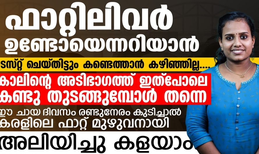 ഫാറ്റി ലിവറിനെ മറികടക്കാൻ കഴിക്കേണ്ട ഭക്ഷണങ്ങളെ കുറിച്ച് ഇതുവരെയും അറിയാതെ പോയല്ലോ…| Fatty liver diet foods