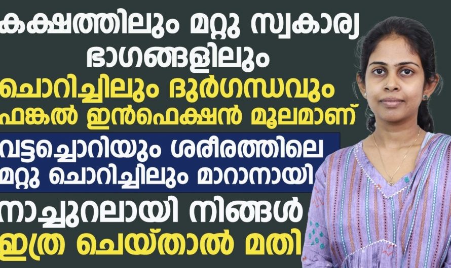 അടിക്കടി ഫംഗസ് അണുബാധകൾ നേരിടുന്നവരാണോ നിങ്ങൾ? എങ്കിൽ ഇത്തരം കാര്യങ്ങൾ ആരും അറിയാതെ പോകരുതേ.