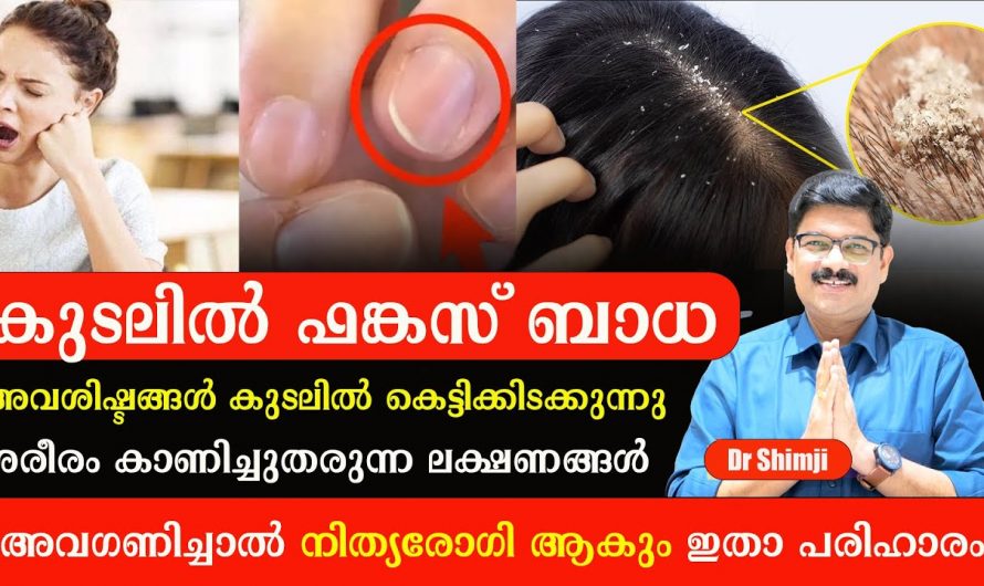 വയറിനകത്ത് ഫംഗസുകൾ പെറ്റു പെരുകുമ്പോൾ ശരീരം പ്രകടമാക്കുന്ന ഇത്തരം ലക്ഷണങ്ങളെ ആരും തിരിച്ചറിയാതെ പോകരുതേ.