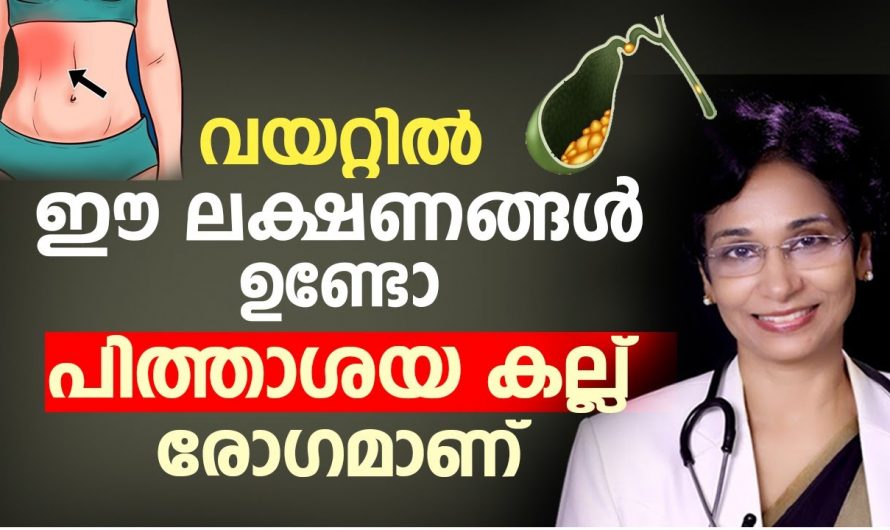 പിത്താശയെ കല്ലിനെ ശരീരം പ്രകടമാക്കുന്ന ഇത്തരം ലക്ഷണങ്ങളെ ആരും അറിയാതെ പോകരുതേ.