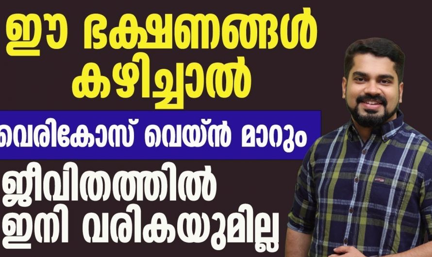 സർജറി പോലുമില്ലാതെ വെരിക്കോസ് വെയിനിനെ പൂർണ്ണമായി മാറ്റുവാൻ ഇത്തരം ഭക്ഷണങ്ങൾ ശീലമാക്കൂ. ഇതാരും അറിയാതെ പോകരുതേ.