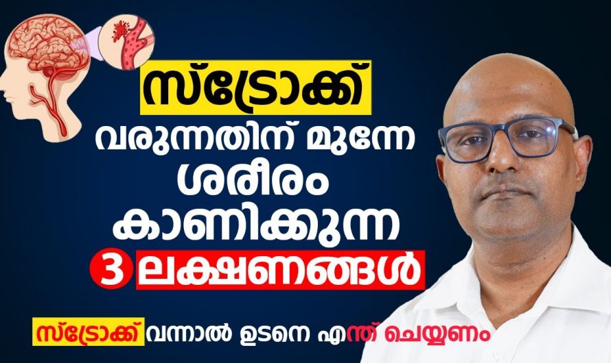 പക്ഷാഘാതത്തിന് ശരീരം പ്രകടമാക്കുന്ന ഇത്തരം ലക്ഷണങ്ങളെ ആരും നിസാരമായി തള്ളിക്കളയരുതേ…| 3 symptoms of stroke