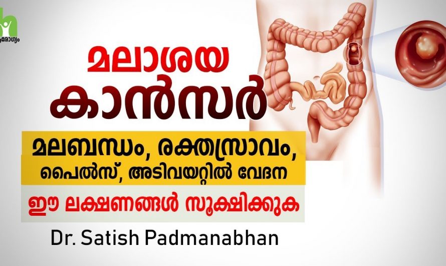 മലാശയ ക്യാൻസറിനെ ശരീരം കാണിച്ചു തരുന്ന ഇത്തരം ലക്ഷണങ്ങളെ ആരും തിരിച്ചറിയാതെ പോകരുതേ…| Rectal cancer causes male