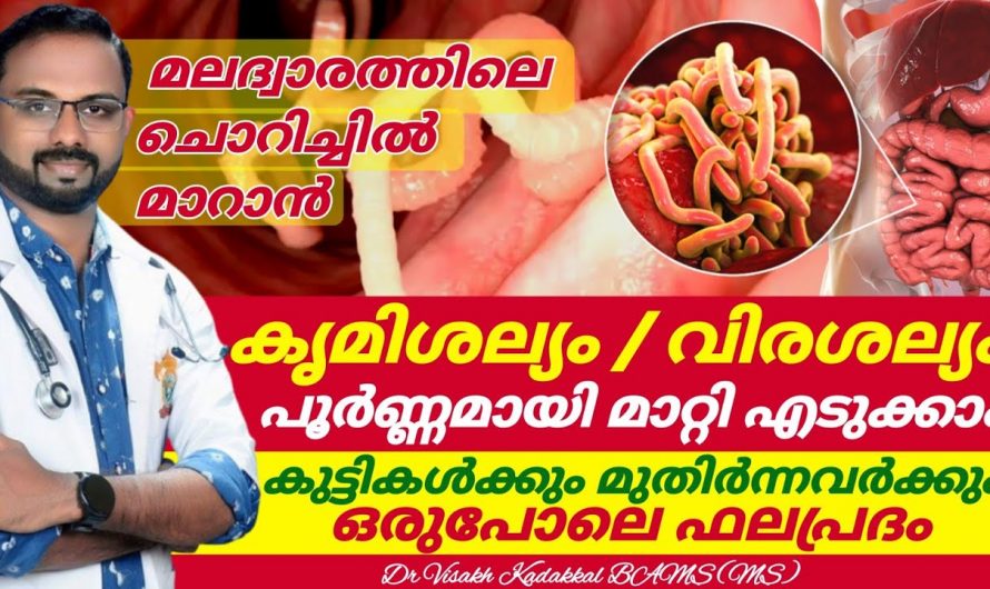 കുട്ടികളിലെയും മുതിർന്നവരിലേയും വിരശല്യത്തെ എന്നന്നേക്കുമായി മാറ്റുവാൻ ഇതാരും കാണാതെ പോകല്ലേ…| Get rid of worm infestation