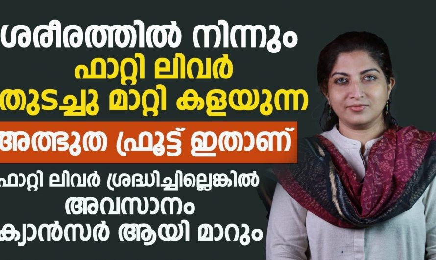 ഫാറ്റിലിവറിനെ മറികടക്കാൻ ഇത്രയ്ക്ക് എളുപ്പമായിരുന്നോ ? ഇതാരും അറിയാതെ പോകരുതേ…| Fatty liver symptoms in females