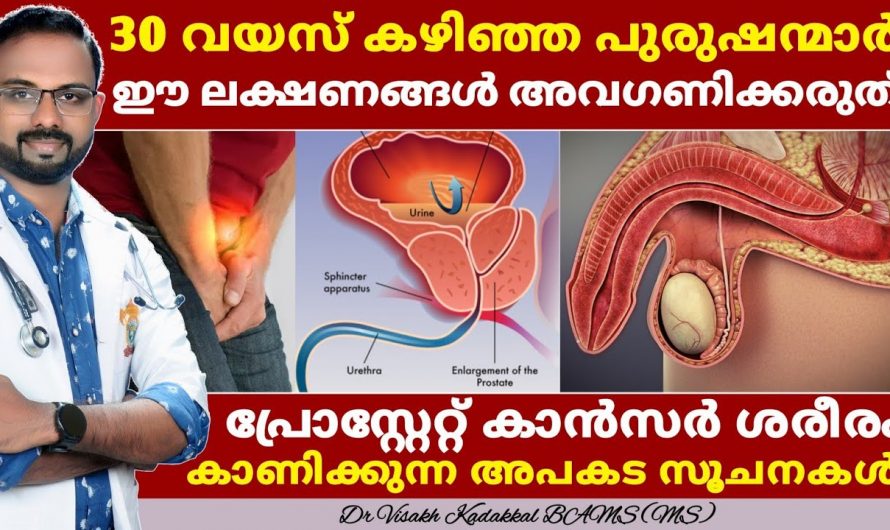 പ്രോസ്റ്റേറ്റ് ക്യാൻസറിനെ ശരീരം പ്രകടമാക്കുന്ന ഇത്തരം ലക്ഷണങ്ങളെ ആരും അറിയാതെ പോകരുതേ