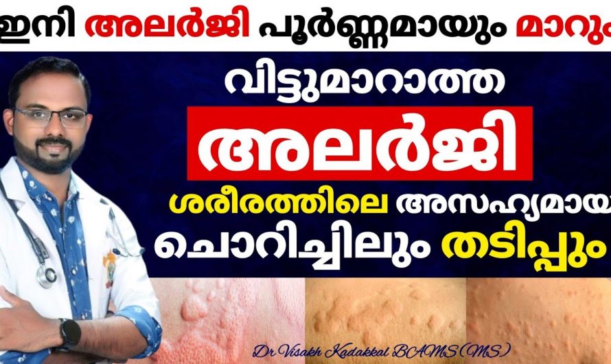 ഏതുതരം അലർജി ആയാലും പരിഹാരം ഇതാ ഇവിടെയുണ്ട്. ഇതാരും നിസ്സാരമായി കാണരുതേ…| How to get rid of allergy