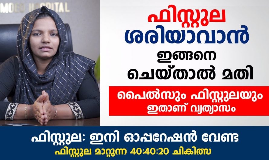 ഒരൊറ്റ മരുന്നു പോലുമില്ലാതെ ഫിസ്റ്റുലയെ മാറ്റുന്നതിന് വേണ്ടി ഇത്തരം കാര്യങ്ങൾ ആരും അറിയാതെ പോകല്ലേ…| Piles and fistula symptoms