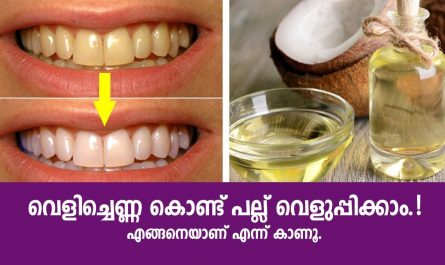Whitening teeth with coconut oil