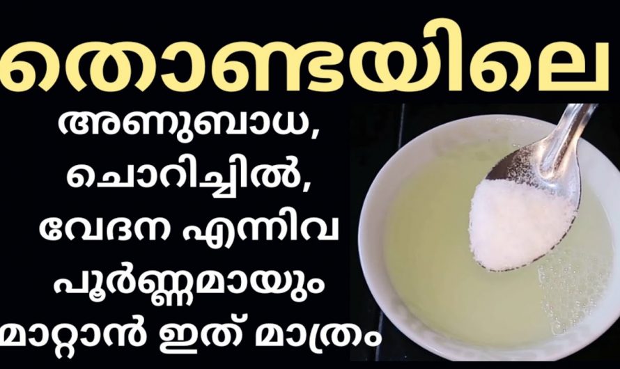 ഒരൊറ്റ യൂസിൽ തന്നെ തൊണ്ടയിലെ ഇൻഫെക്ഷൻ അകറ്റാൻ ഇതു മതി. ഇതാരും നിസ്സാരമായി തള്ളിക്കളയരുതേ…| Throat infection symptoms